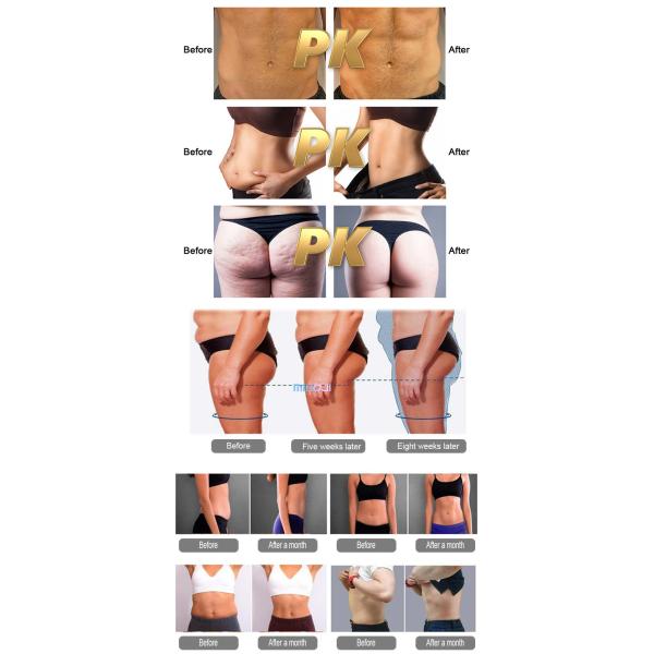Инфракрасный скульптор тела AC110V с воздушным и водяным охлаждением