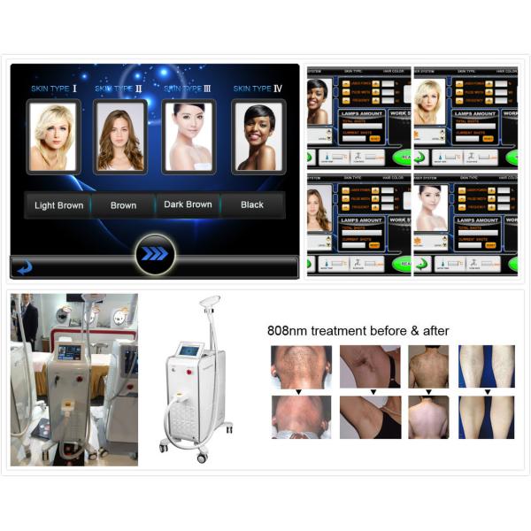 808nm Diode Laser Hair Removal Machine 400ms Adjustable