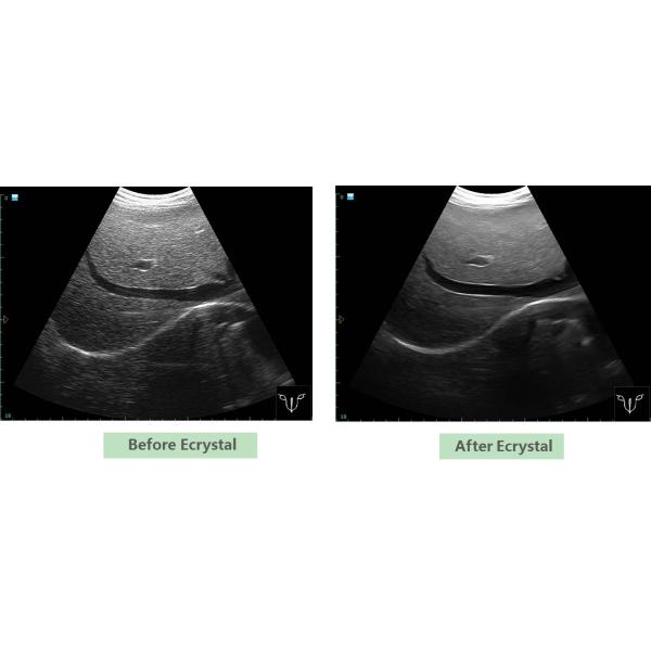 High Resolution Laptop B/W Ultrasound MSK Ultrasound Scanner Laptop Ultrasound Machine