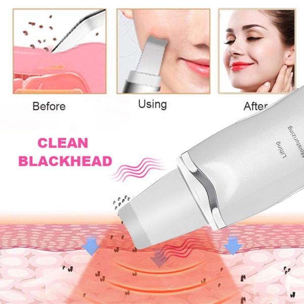 Ultrasonic Skin Scrubber Deep Cleaning Face Scrubber Vibrating Facial Cleansing Skin Spatula Peeling Beauty Instrument D