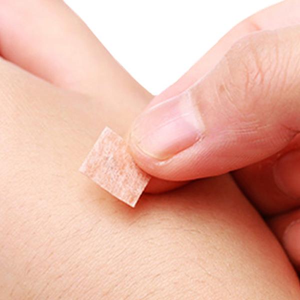 Experience the Benefits of Acu Press Needles for Chinese Medicine Apparatus