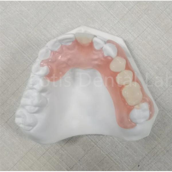 Pink / Transparent TCS Valplast Odor Resistant Flexible Dental Prosthesis