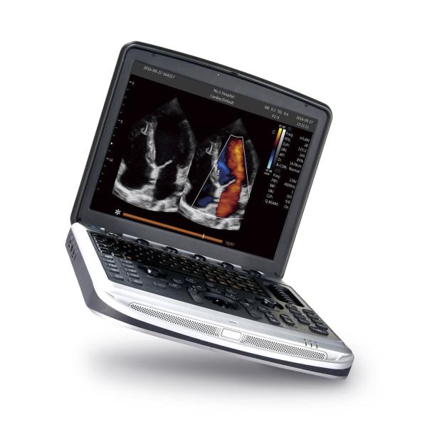 Easy To Carry 4D Chison SonoBook 9 Laptop Ultrasound Machine