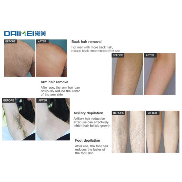 Comfortable 808nm Permanent Hair Removal Laser Machine For Armpit / Bikini Area