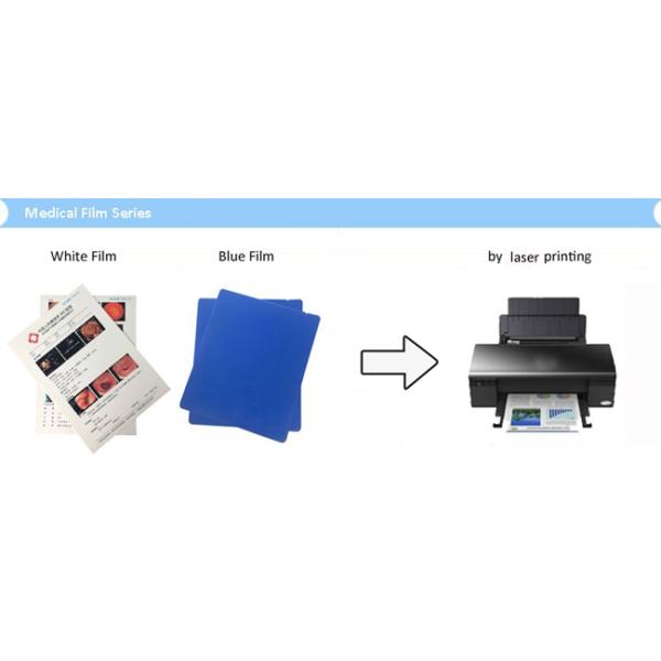 150 película de la proyección de imagen médica del laser X Ray del Mic Digitaces para las hojas del ultrasonido 100 por paquete