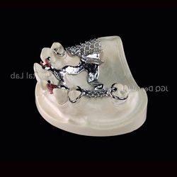 3D Printing Co Cr Alloy Removable Denture Framework Customized for Oral Restoration