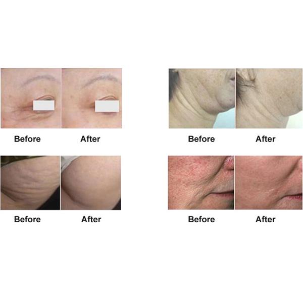 26400pcs LED Red Light Therapy Beds Whole Body Coverage Medical Laser Equipment