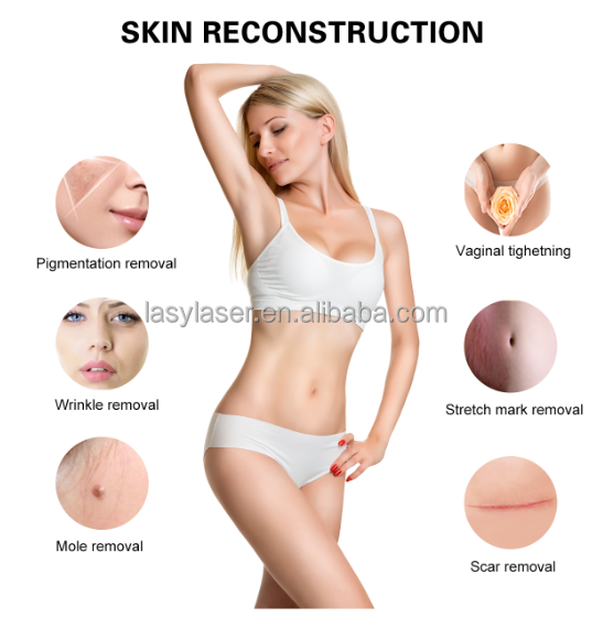 Машины лазера СО2 эрбия дерматологии машина лазера подмолаживания кожи частичной влагалищная