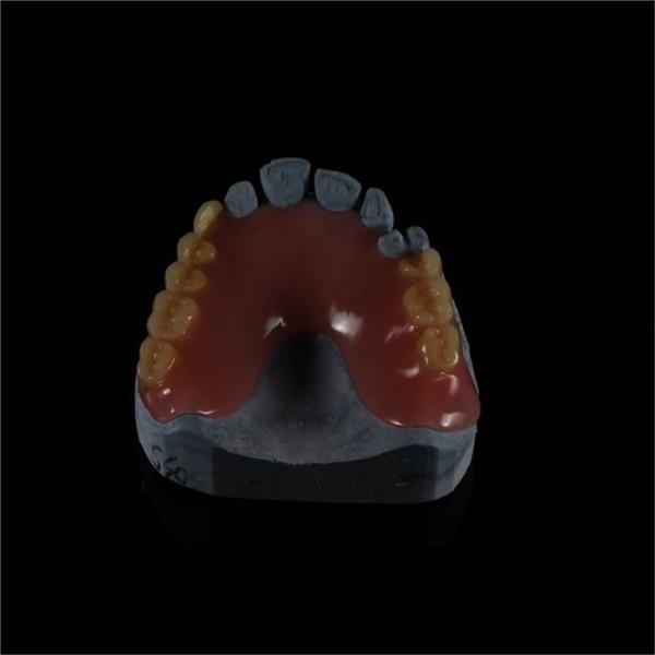 Custom Made Acrylic Removable Partial Denture Single Tooth