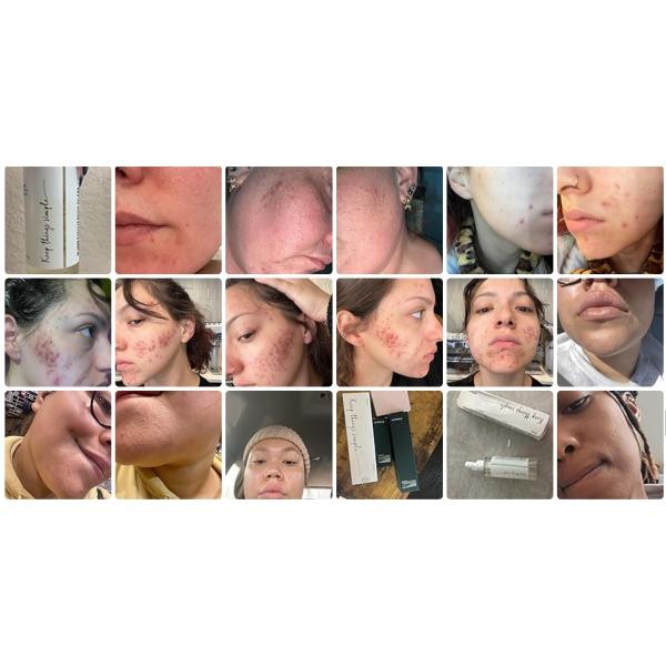 ODM Heartleaf Pore Control Moisturizing Facial Cleanser Oil For Face Makeup Blackhead Remover 6.76 Fl Oz