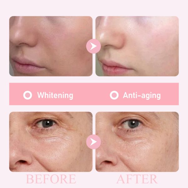 OEM Professional Factory 5 in 1 Anti-aging Acne Remova Moisturizing Whitening Repair  Face Serum Beauty Personal Care Products