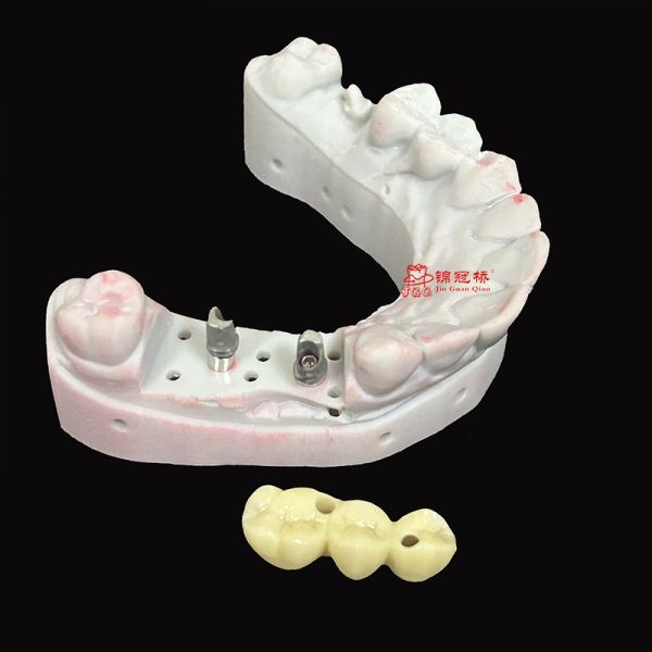 Dental Implants Custom Titanium Abutment Corrosion Resistant FDA Certification