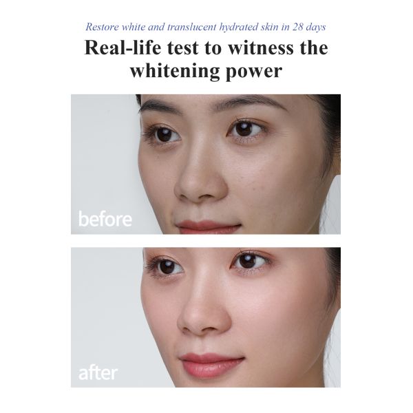 Manufacturer's Luxury Anti-Aging Facial for Essence Anti-Wrinkle Moisturizing Whitening Serum for Premium Home Use Skin Care