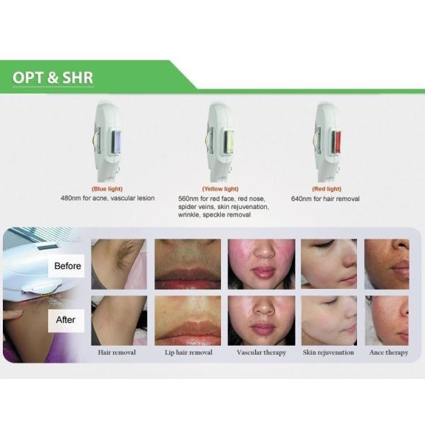 1064nm/532nm OPT IPL RF ND YAG Laser Hair Removal Machine 3 Handles