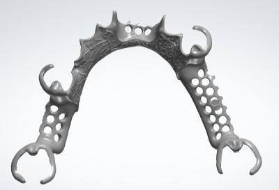 Digital Metal Frame for Precision Applications and Durable Construction