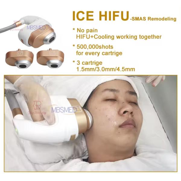 Hifu helado Refrigeración facial y corporal Radiofrecuencia Elevación facial Cryo Hifu Máquina Smas Apretamiento de la piel