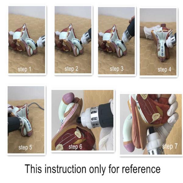 Physiotherapy Equipment Electric Pulse Massage Machine Electromagnetic Therapy Machine