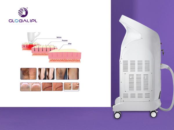 TUV Medical Diode Hair Removal Laser Machine 10Hz Frequency 56x40x108cm Size