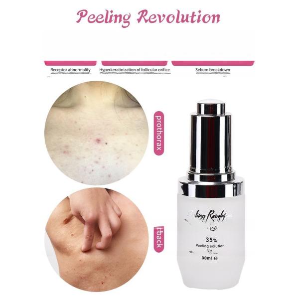Facial Deep Cleansing Skin Peeling Serum Oil Whitening Exfoliate Liquid 30ml