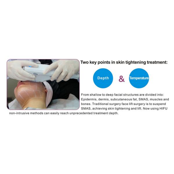 Women Use Hifu Beauty Machine 4MHz HIFU Frequency For Skin Rejuvenation / Pore Removal