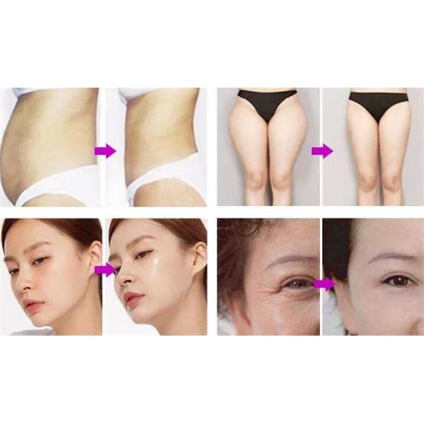 Vertical Vela Shape Machine Rf Roller Vacuum 40k Cavitation For Body