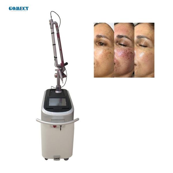 a remoção q da tatuagem de 532nm 1064nm Pico Laser comutou a máquina do laser do yag do nd do interruptor do removedor q das sardas da máquina do laser do Nd Yag