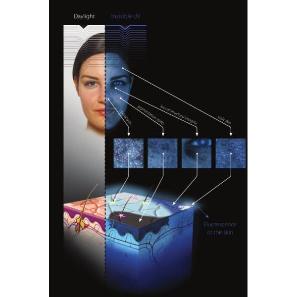 OBSERV 520 Lastest Skin Analyzer Best Skin Tester Professional Skin Scanner