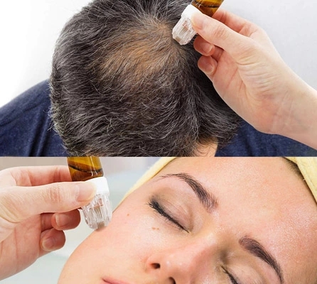 NO Plugs Type Newly Designed 42/150Gold Titanium Microneedle Hydra Stamphydra Roller for Skin Rejuvenation