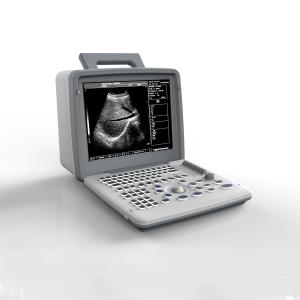 Полная машина 0 развертки цифров OB GYN USG к дисплею 120dB 12in приведенному