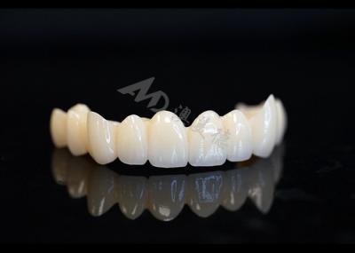 Precision Made Solid Zirconia Crown For Perfect Dental Fit And Comfort