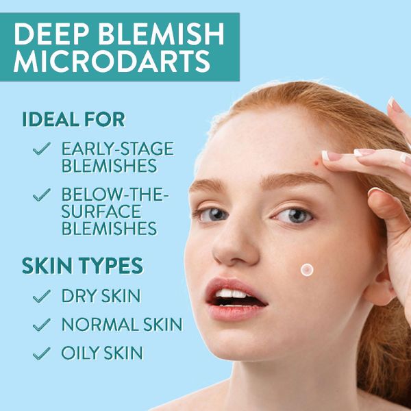 6 Counts Hydrocolloid Pimple Patches Anti Inflammatory Microneedle Acne Patches