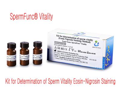 Diagnóstico masculino da infertilidade para a vitalidade de avaliação do esperma