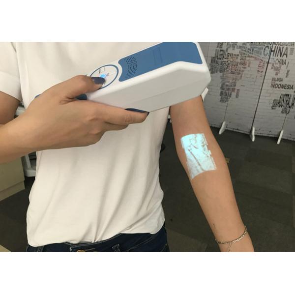 Handheld Portable Vein Finder Device For Nurses And Doctors With Special Light Source