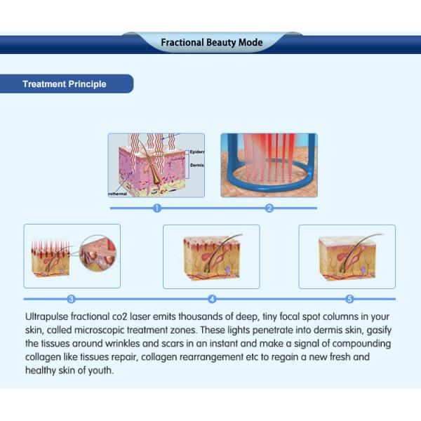 Hot sale scar removal stretch mark removal 10600nm Fractional Co2 laser machine