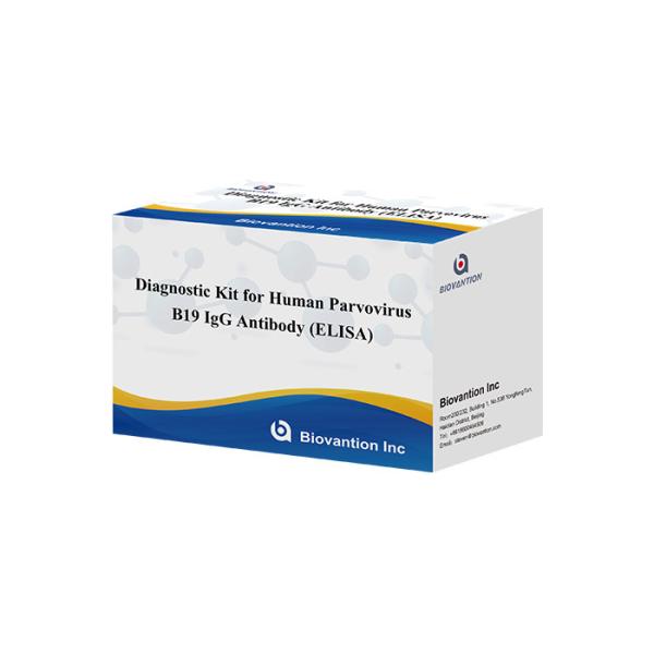 Antibody To Human Parvovirus B19 IgM ELISA Test Kit Diagnostic Kit
