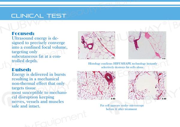 Advanced VERTICAL ultrasound machine/hifu body slimming machine/body slimming hifu