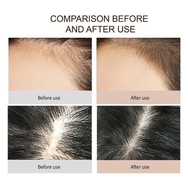 400ml ODM Organic Shampoo Natural Shower Gel For Hair Growth Set