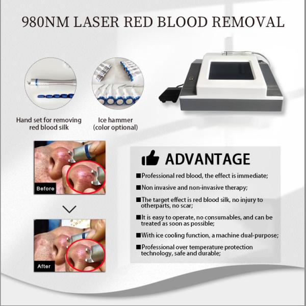 980nm Laser Vascular Removal Machine Spider Broken Capillary Vein Treatment