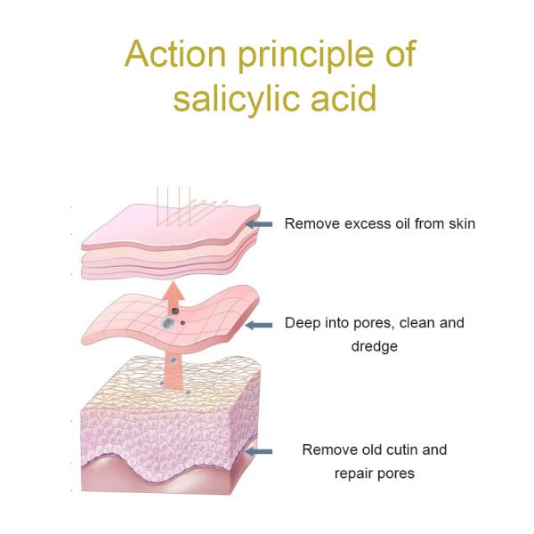 Poros faciales de hidratación ácidos salicílicos del ODM de la tinta que minimizan la tinta