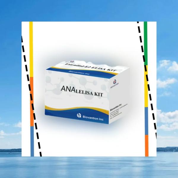 Anti ANA IgG ELISA Test Kit Anti Nuclear IgG Antibody Qualitative Detection
