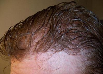 Toupet pour homme 100% cheveux humains pour une transformation de la ligne de cheveux naturelle