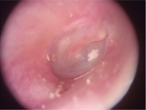 Oftalmoscopio portátil recargable Dermatoscope del otoscopio con salida de tarjeta del SD