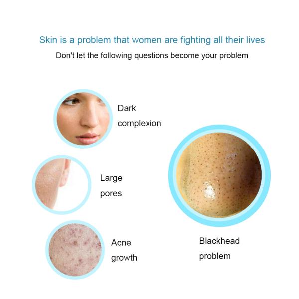 Eco Friendly Electric Blackhead Remover Tool Beauty Skin Acne Rejuvenation