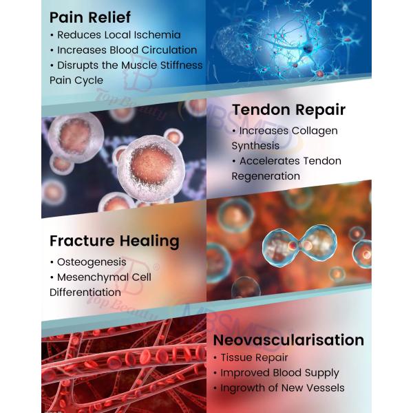 Focused shockwave Musculoskeletal Rehabilitation Focused Shockwave Therapy Osteopathy Equipment