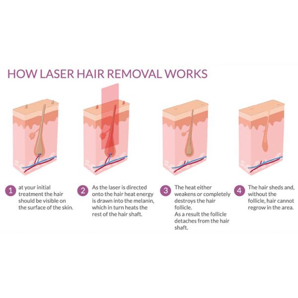 Medical CE Approved E-Light IPL RF Beauty Equipment For Wrinkle Removal