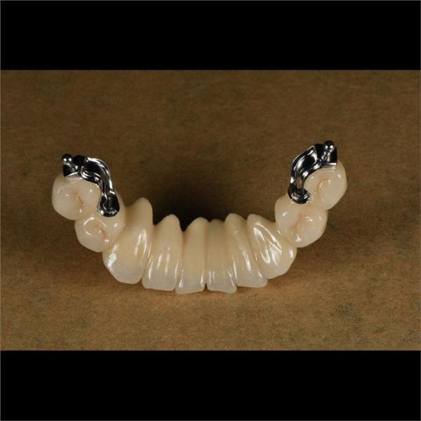 Aesthetic Partial Denture Precision Attachments Medical Grade OEM