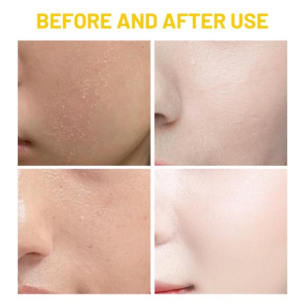 77.8% tonifiant pour le riz Niacinamide éclairant le visage hydratant hydratant doux éclatant la peau tonifiant le visage pour la peau sensible