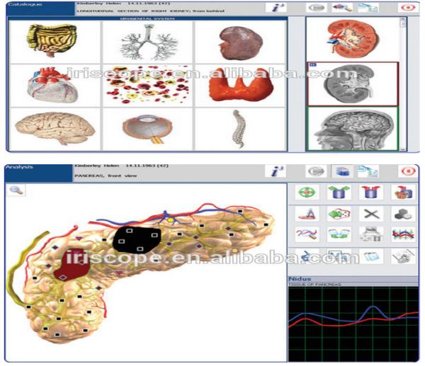 Black Virtual Scanning High Accuracy Metatron Nls 4025 Hunter Body Analyzer Multilanguage