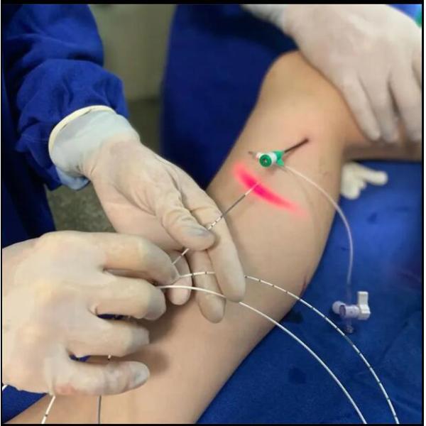 Лазерная машина Holmium Laser Medical Fiber хирургический лазерный аппарат Липолиз волоконного лазера / геморройный медицинский волоконный лазер holmium