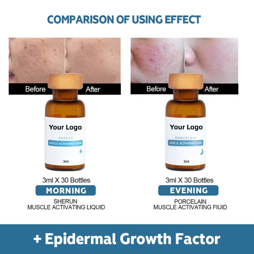 OEM ODM customized brand skin care epidermal growth factor freeze-dried facial essence firming moisturizing cream anti-aging and anti wrinkle facial essence set